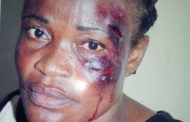 NPP Polling Station Executive Fights For Justice After MP’s Boy Brutalized Her