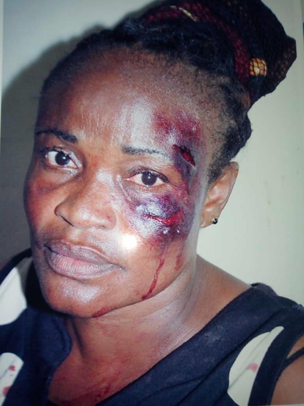 NPP Polling Station Executive Fights For Justice After MP’s Boy Brutalized Her