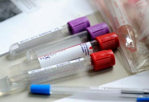 Belgian laboratories are trying to improve efficiency