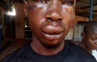 CID Man Brutalizes UEW Student For Chasing His Wife
