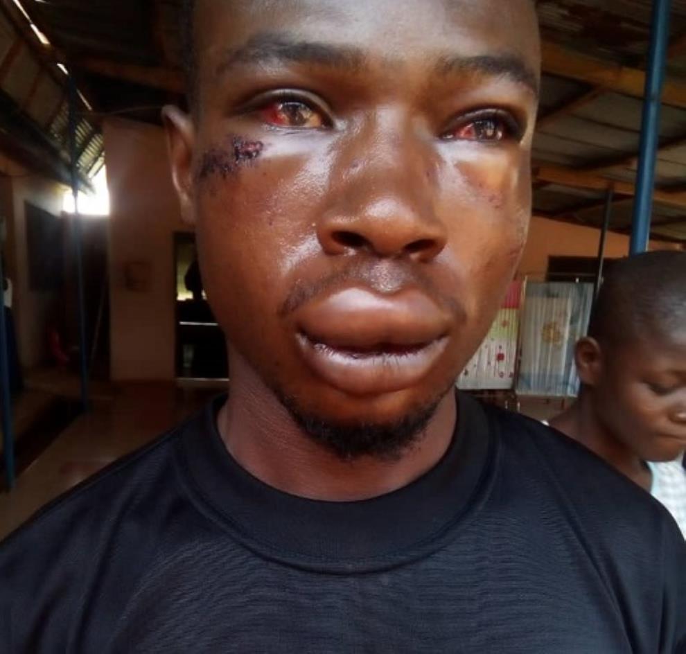 CID Man Brutalizes UEW Student For Chasing His Wife